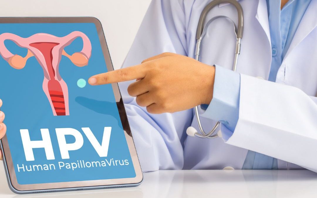 Infecção por HPV na mulher