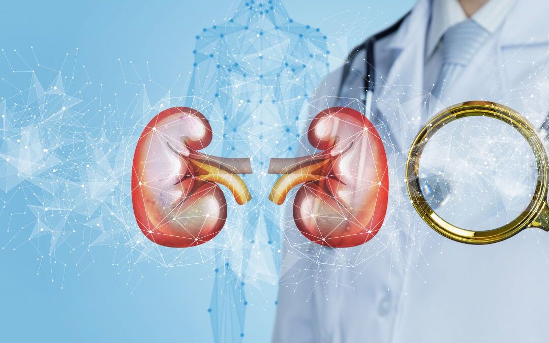 Mitos e Verdades sobre Cálculo Renal